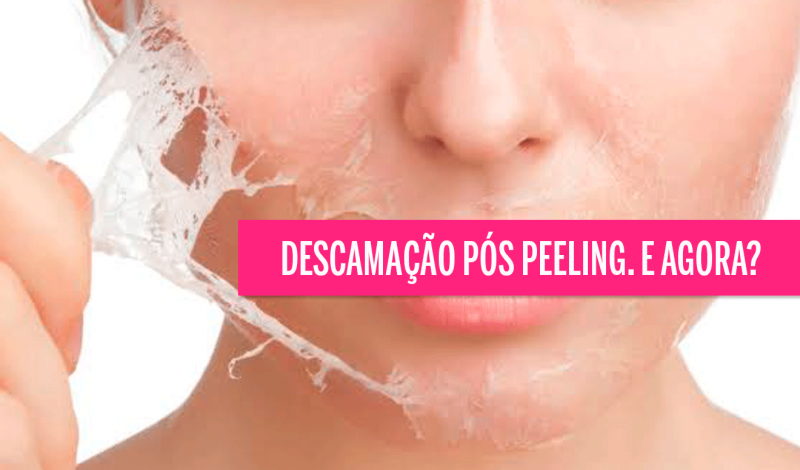 Descamação do Peeling como disfarçar – Cuidados pós Peeling
